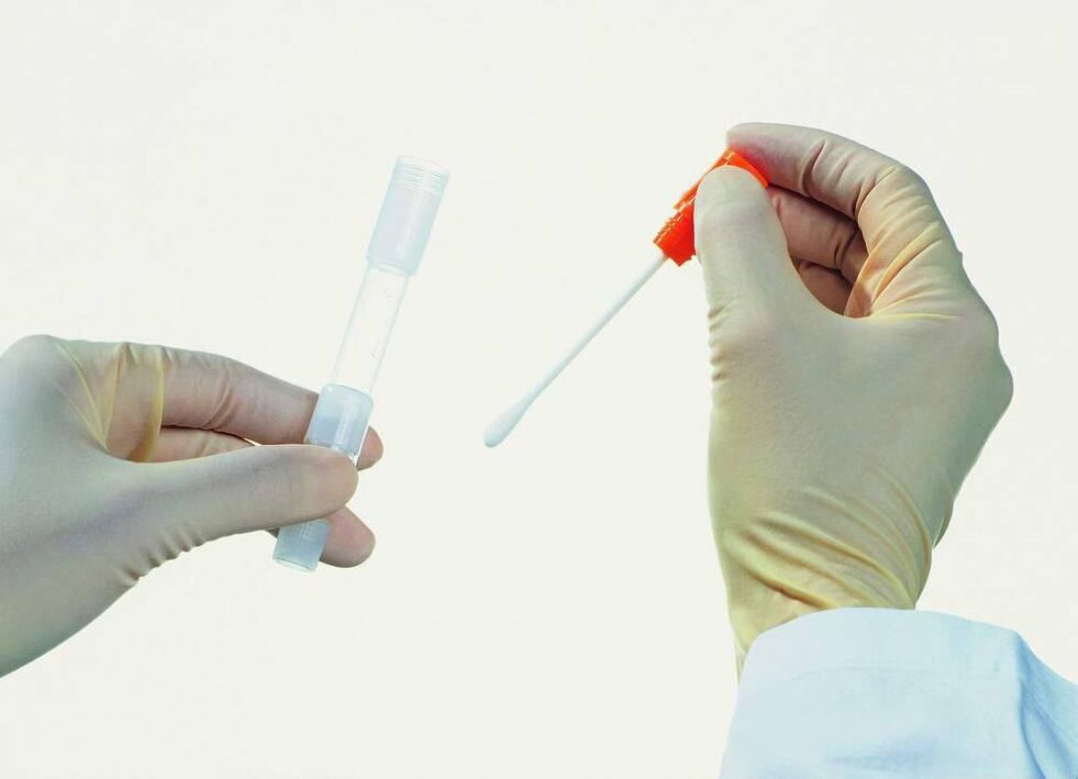 Collect tests to detect chronic prostatitis